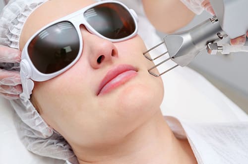 Mulher fazendo depilação a laser no rosto