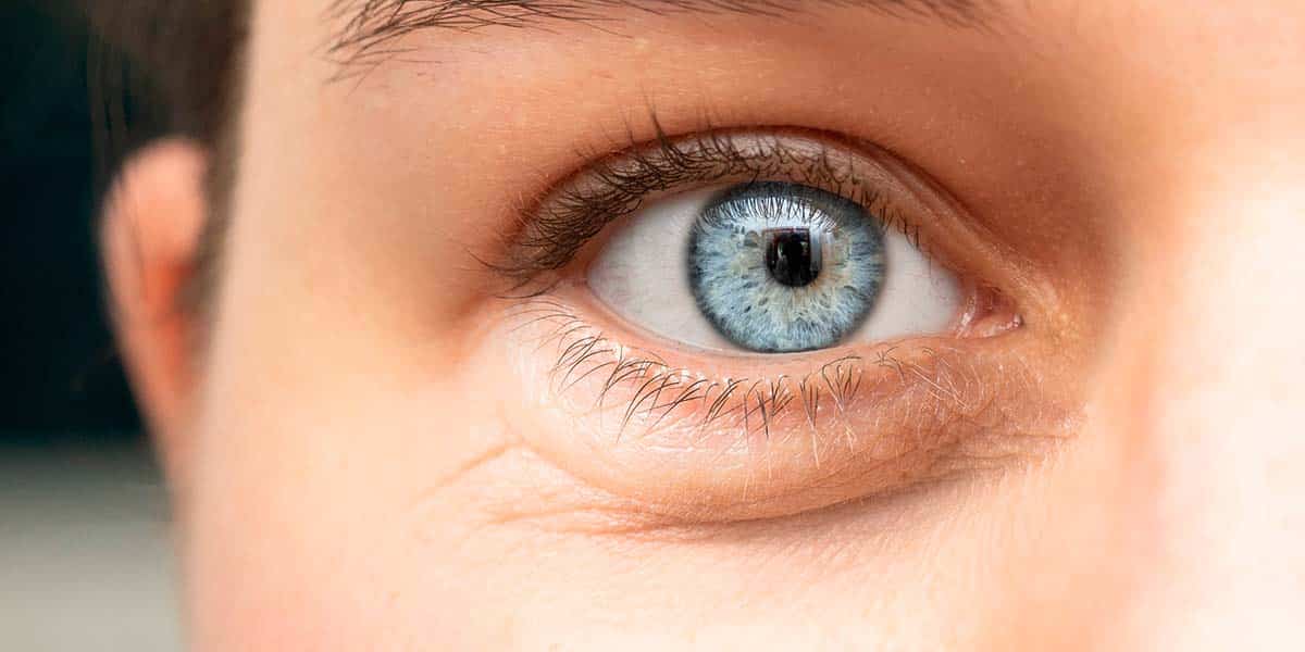 Olhos cor azul com olheira - site Episense clínica de medicina estética facial e corporal em Matosinhos, Porto - Portugal
